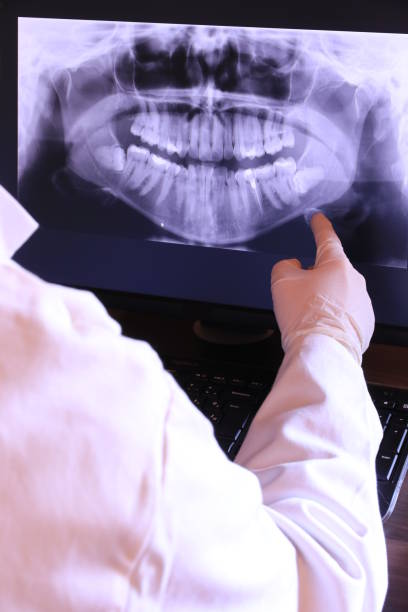 Best Emergency Treatment for Dental Infections or Abscesses in Winnebago, MN